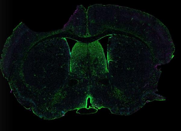 Mouse brain coronal section