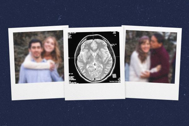 Three polaroid photos - two with couples, one with MRI brain