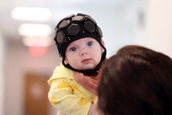 Baby held while wearing brain cap