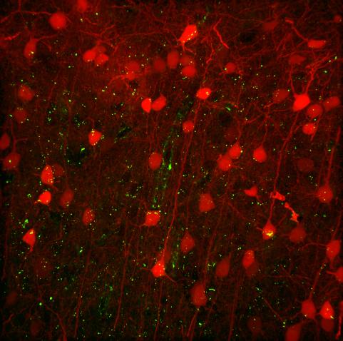 Anastasia Brodovskaya cortex image